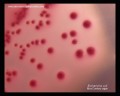 e.coli bile precipitate